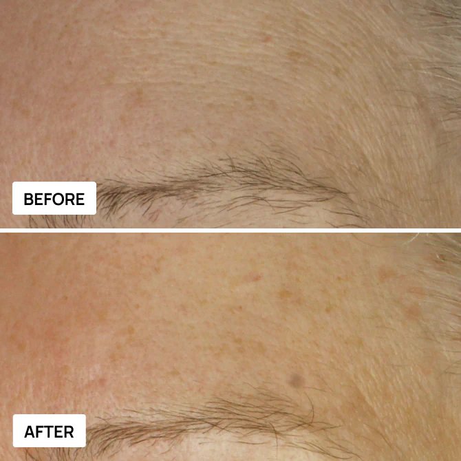 Before and after