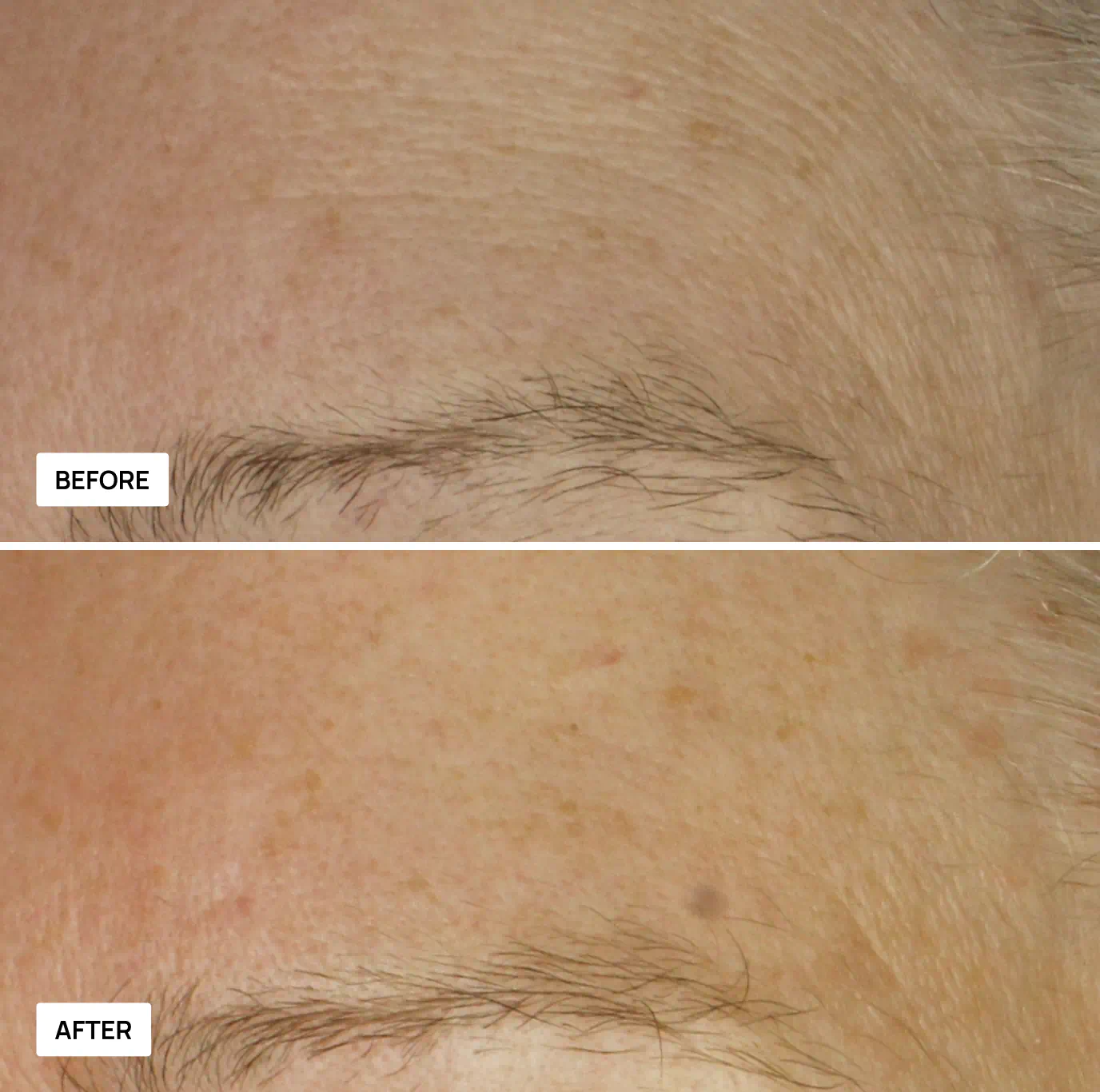 Before and after