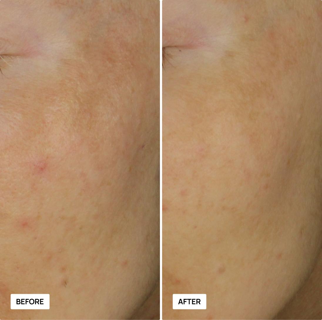 Before and after