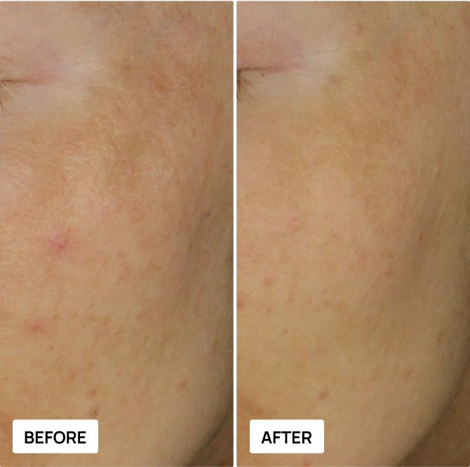 Before and after