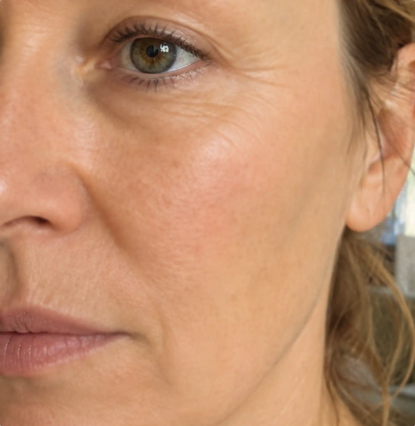 Close-up of the same skin after using the Fine Lines & Saggy Skin System