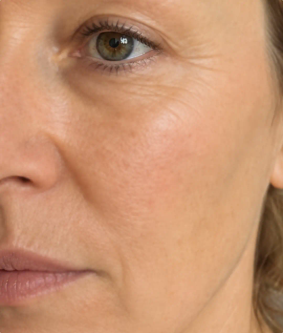 Close-up of the same skin after using the Fine Lines & Saggy Skin System