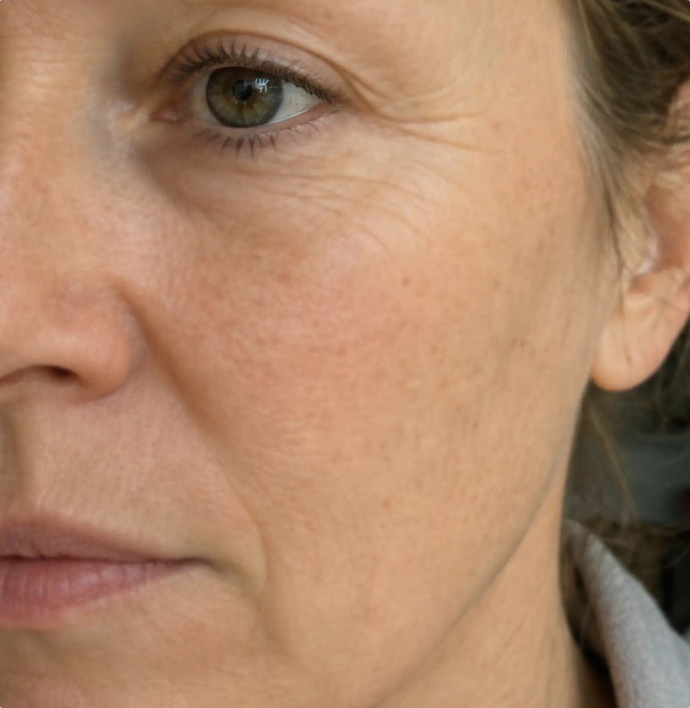 Close-up of mature skin before using the Fine Lines & Saggy Skin System