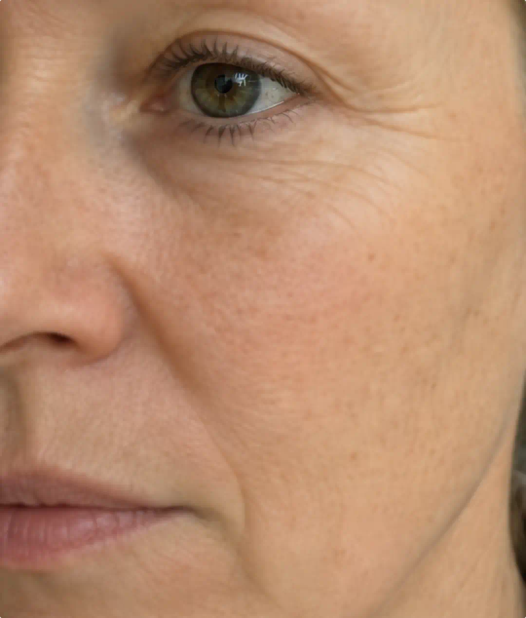 Close-up of mature skin before using the Fine Lines & Saggy Skin System