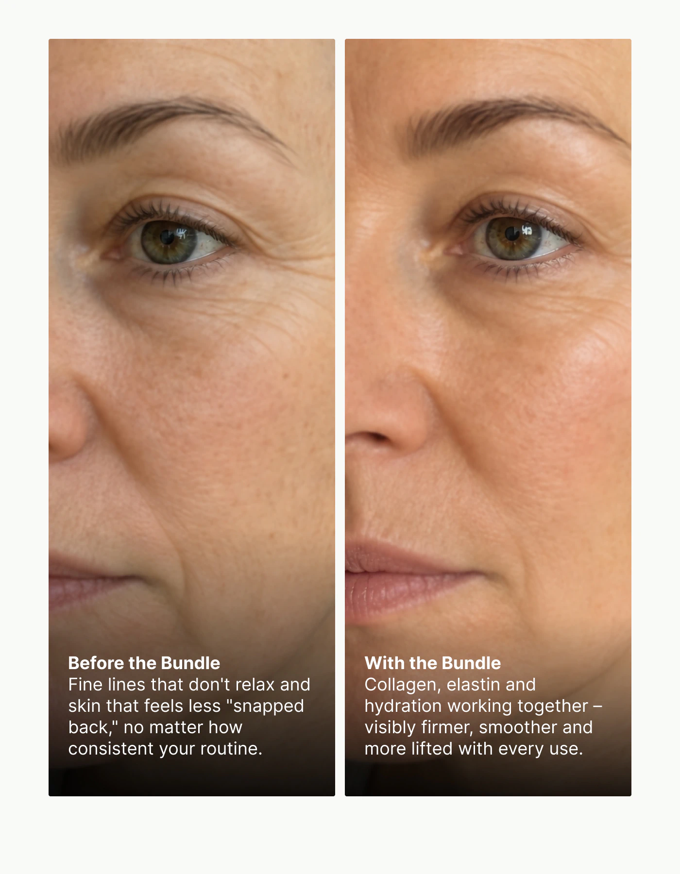 Side-by-side of fine lines before and after Pureance bundle
