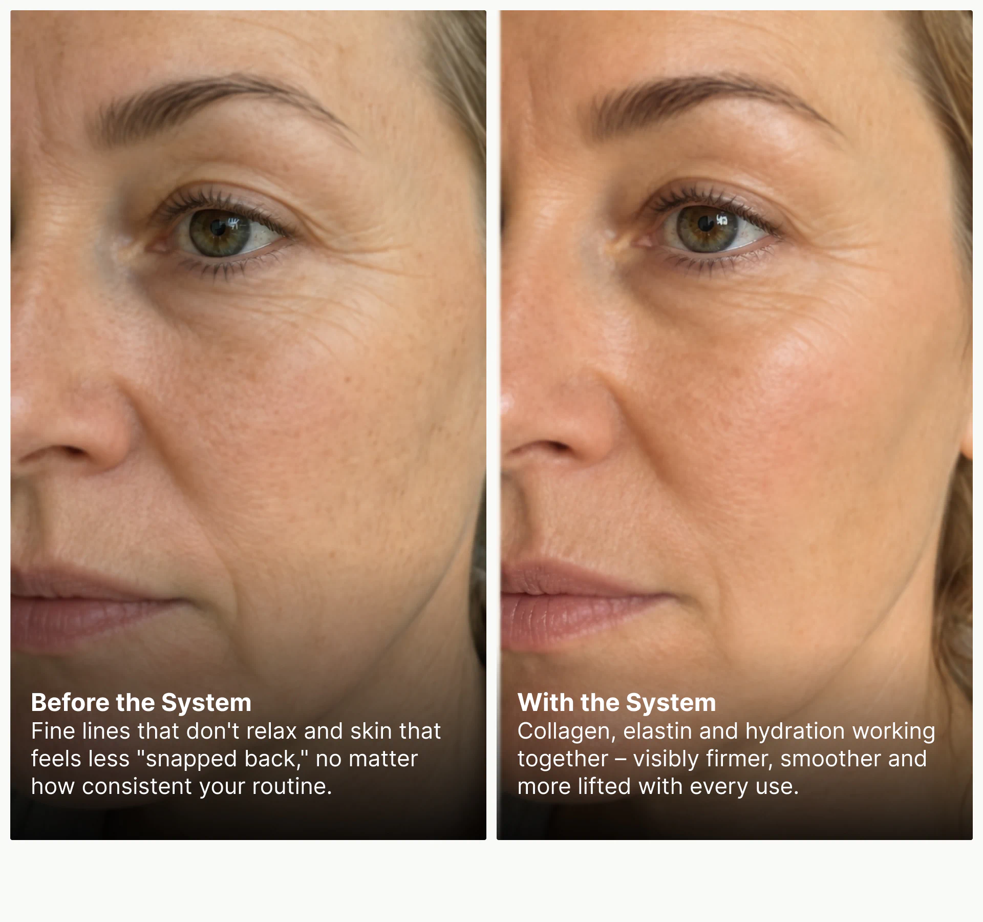 Side-by-side of fine lines before and after Pureance bundle