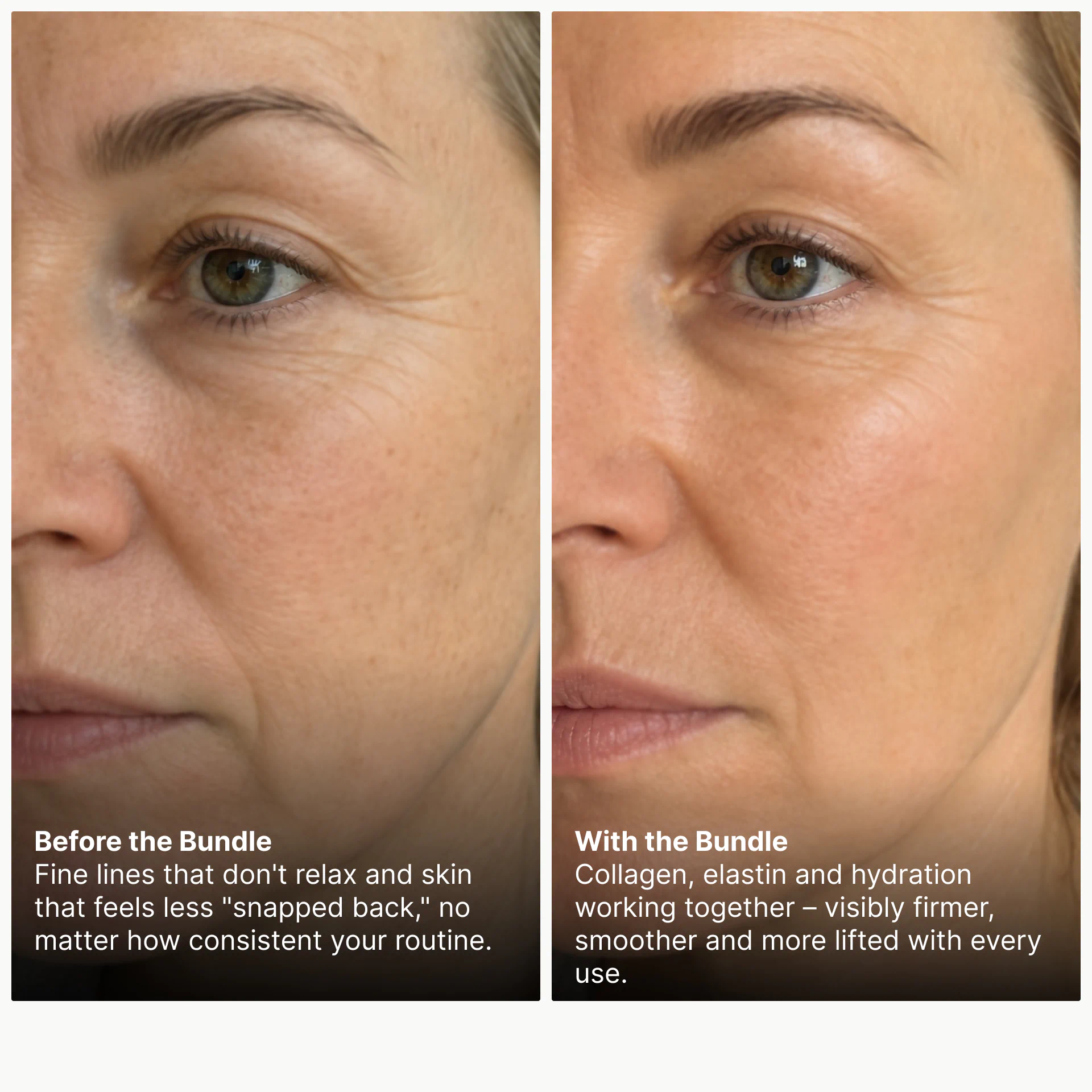 Side-by-side of fine lines before and after Pureance bundle
