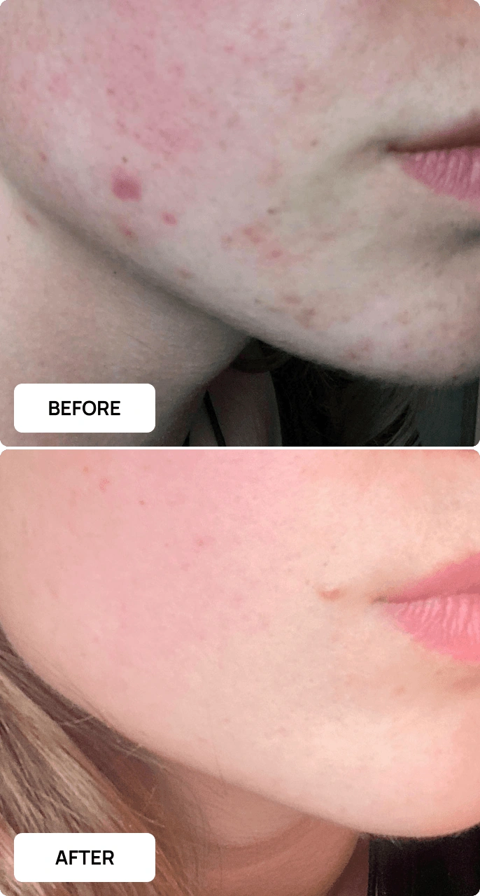 All skincare products before and after