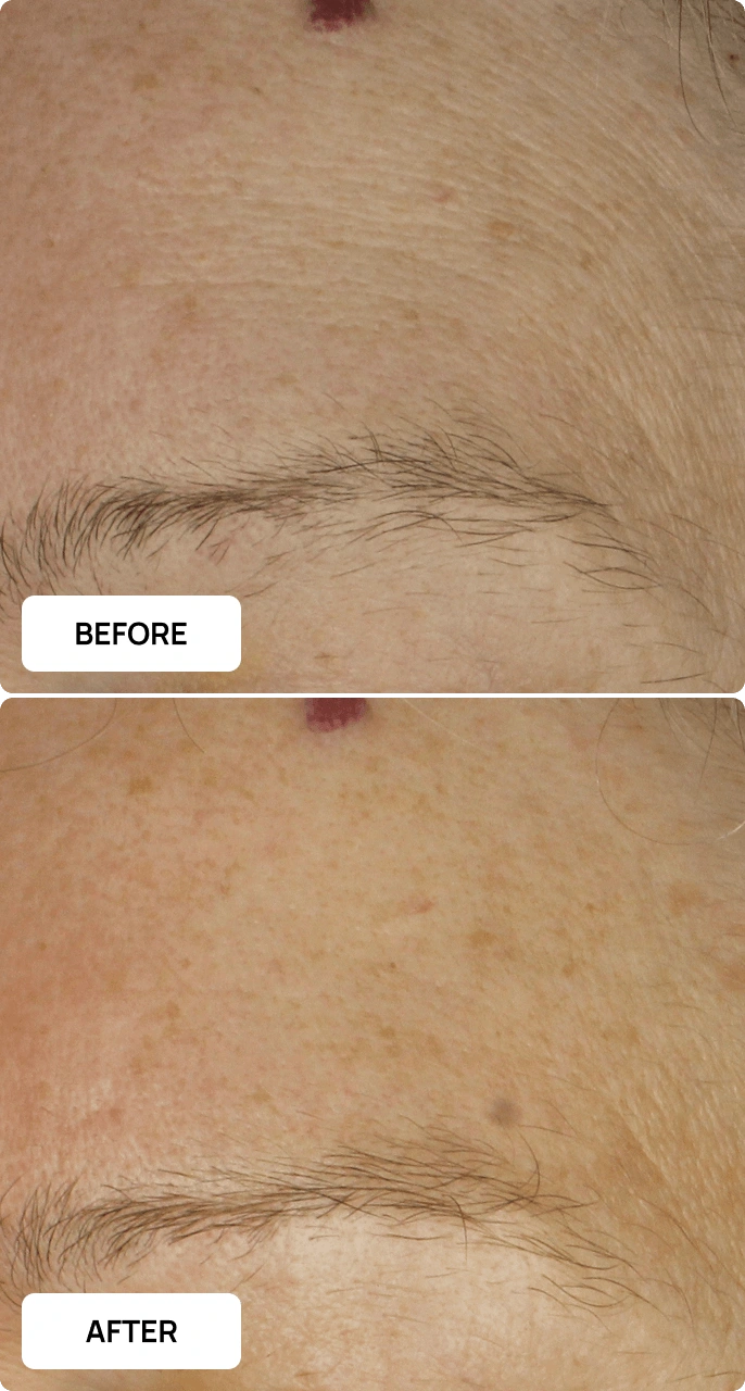 Cellular Restore Serum before and after